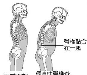 中醫怎麼看由內科疾病所引起的「痛症」？
